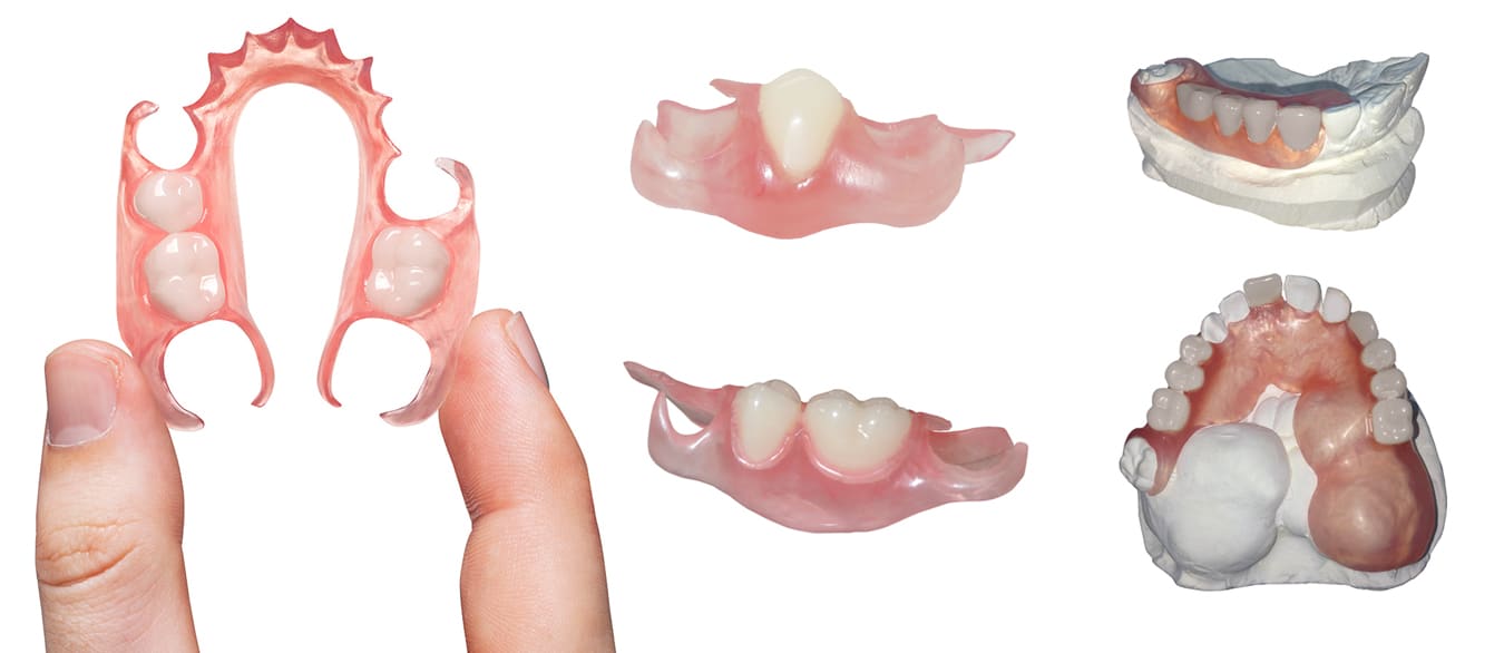Indikacije za silkonske proteze za zube