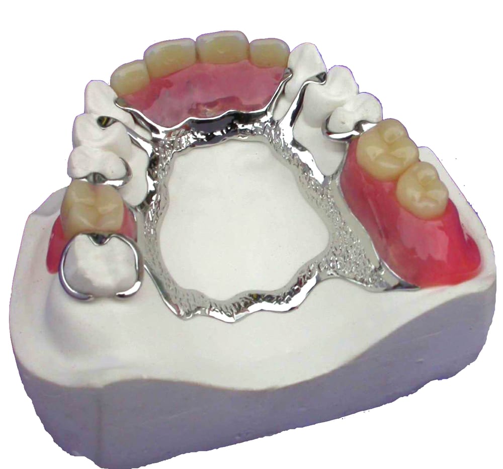 zubne proteze bez nepca