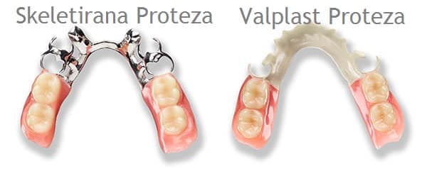 zubne proteze silikonske i skeletirane