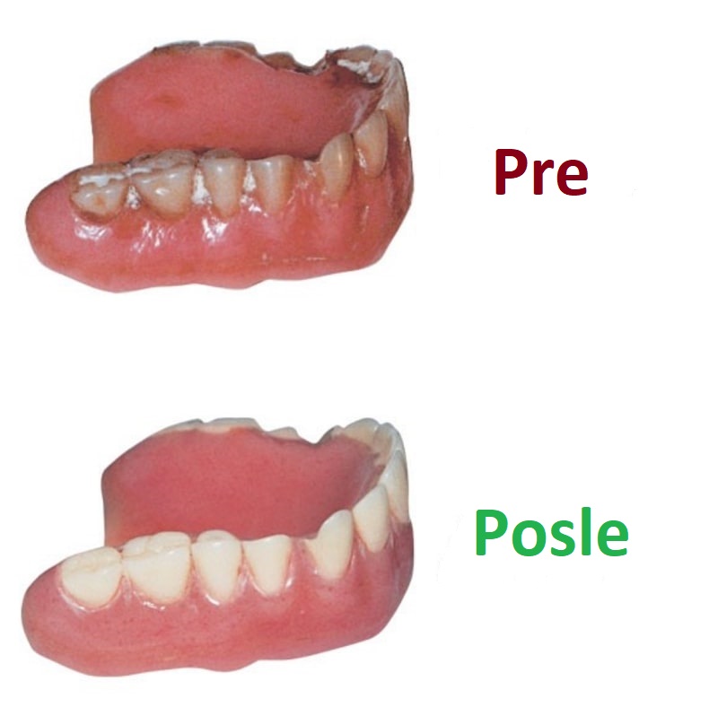 kako izbeliti zubnu protezu